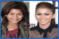 Unveiling The Secrets Of Zendaya's Nose Job: Discoveries And Insights